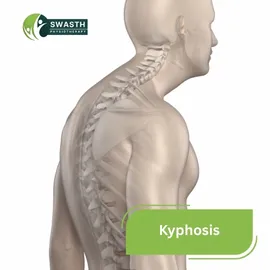 Kyphosis