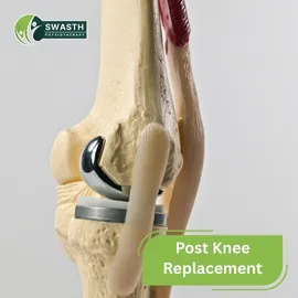 Post knee Replacement