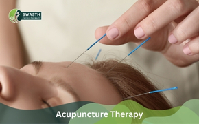 Acupuncture Therapy