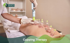 Cupping Therapy